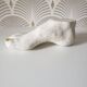 Woman's foot in plaster