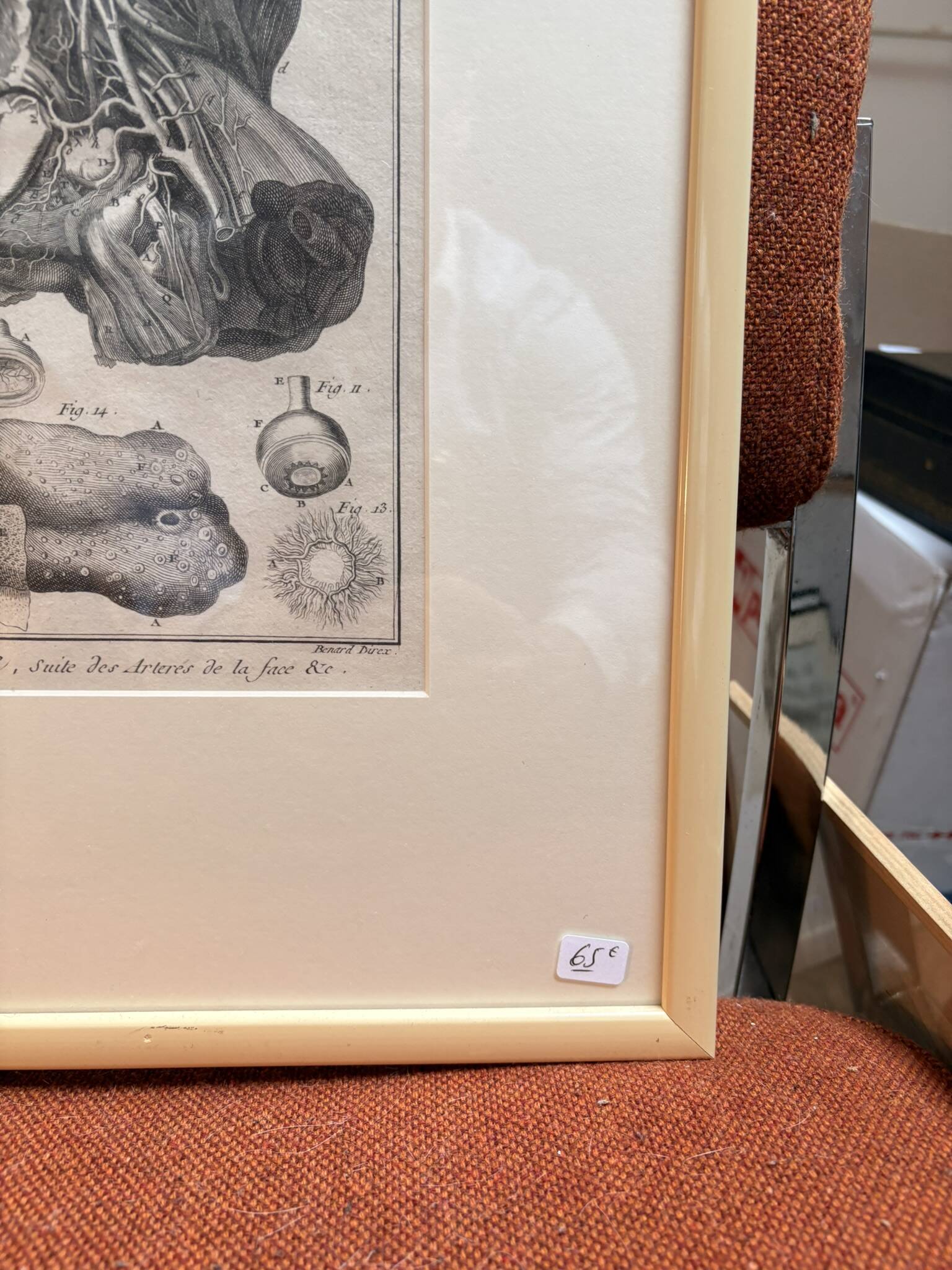 Old Print Engraving 19th Century Framed Anatomy Artery Face Bernard Dixerit