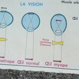 Old MDI school poster, eye-vision & ear-nose
