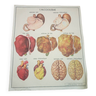 Affiche scolaire Rossignol / L'alcoolisme