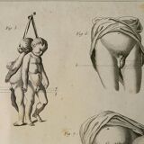 Engravings EIGHTEENth hermaphrodites Diderot cabinet curiosity