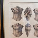Gravure Cheiloplastic Facial Surgery Anatomy Nicolas Jacob Bourgery