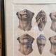 Gravure Chéiloplastique Chirurgie Faciale Anatomie Nicolas Jacob Bourgery