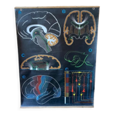 Dr. Auzoux's school poster "The brain"