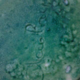 Pitcher Accolay