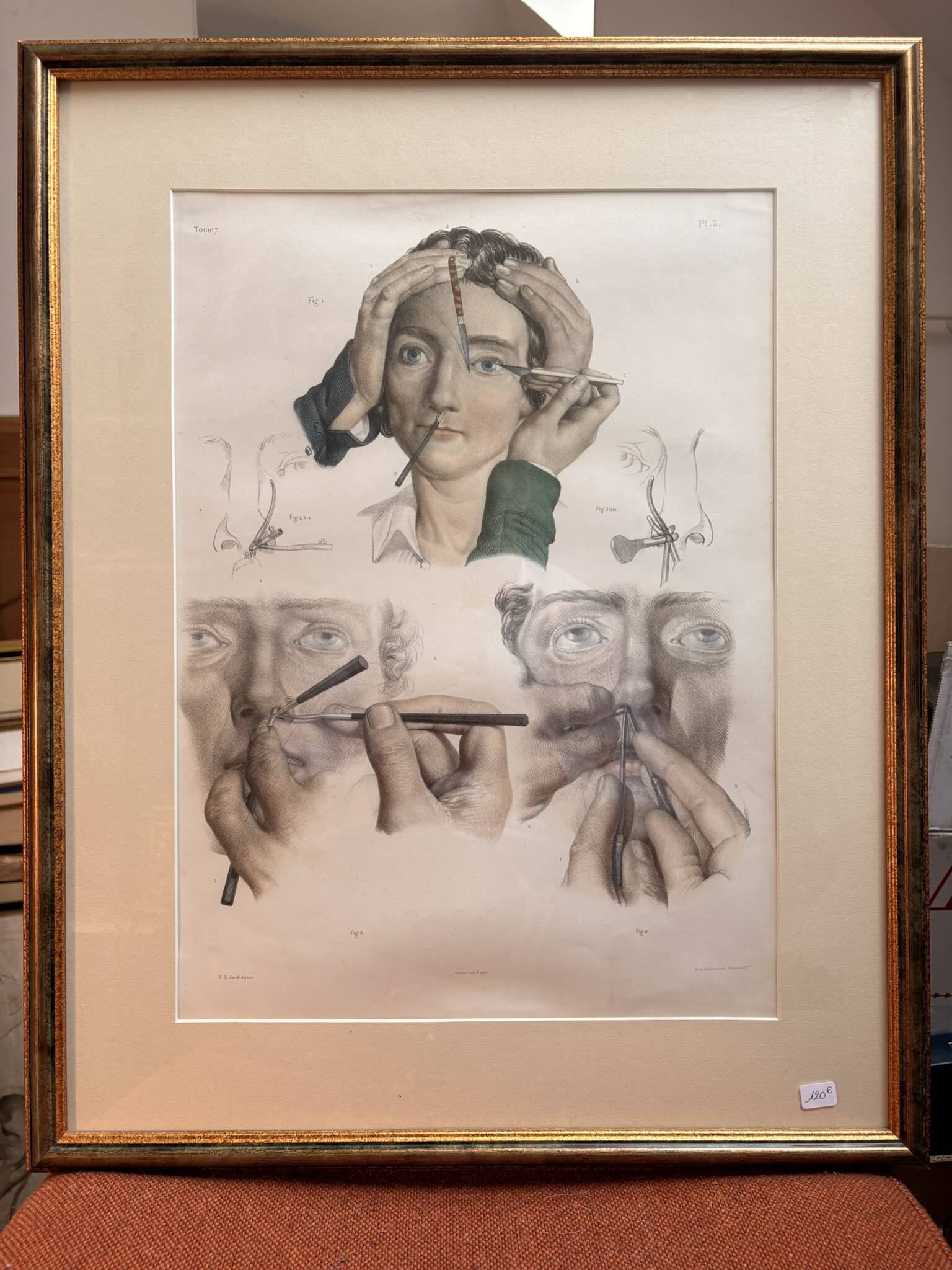 Old Print Engraving 19th Century Anatomy Surgery Atlas Bourgery Nicolas Jacob