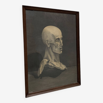Anatomical study, Bust of a skinned person. Late 19th/early 20th.