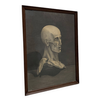 Anatomical study, Bust of a skinned person. Late 19th/early 20th.