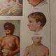 Medical board - anatomy - erysipelas