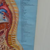 Affiche éducative médicale
