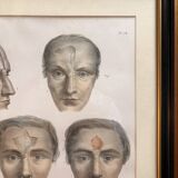 Gravure Plastic Surgery Rhinoplasty NICOLAS Jacob Bourgery Anatomy