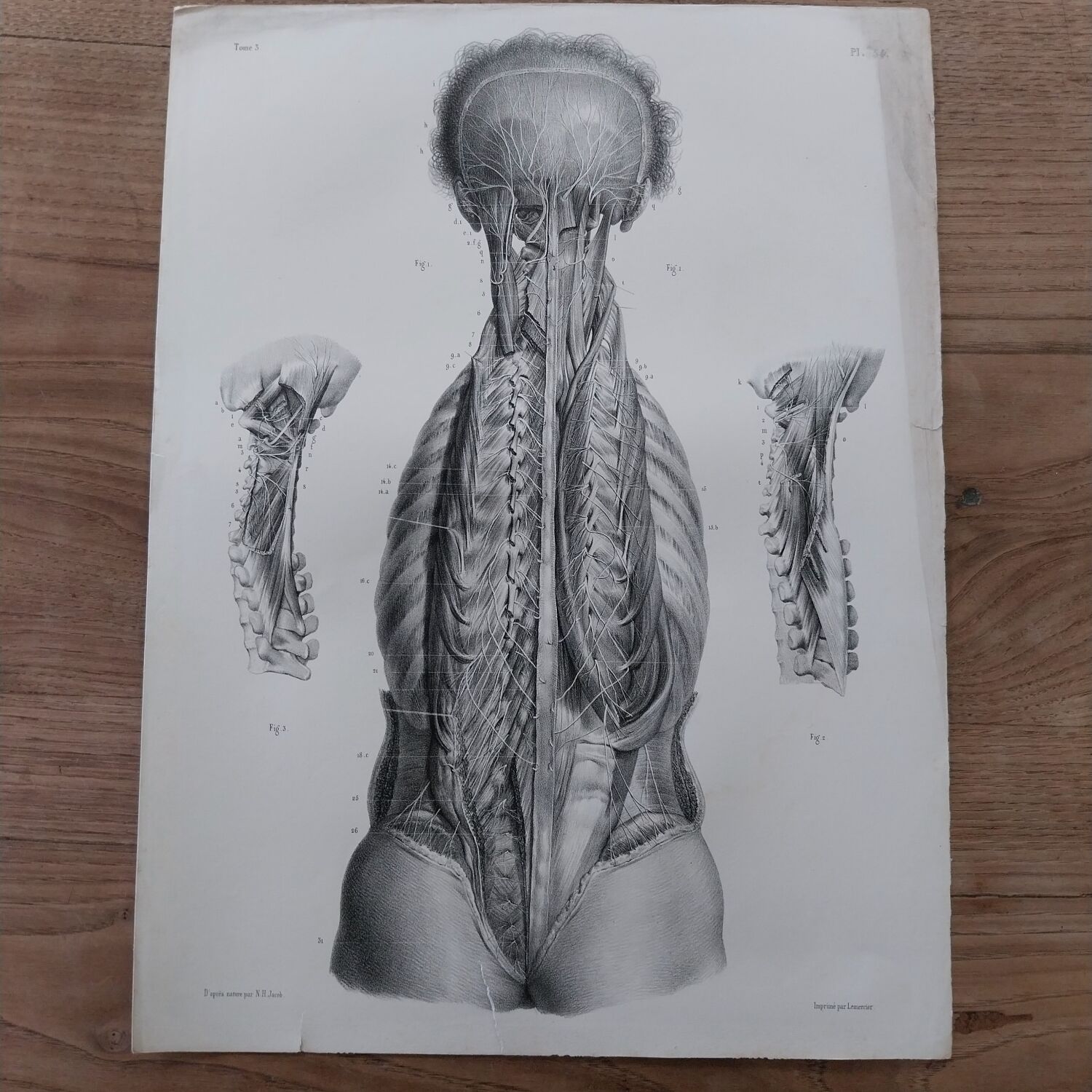 Anatomical chart XIXth