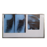 X-ray lightbox