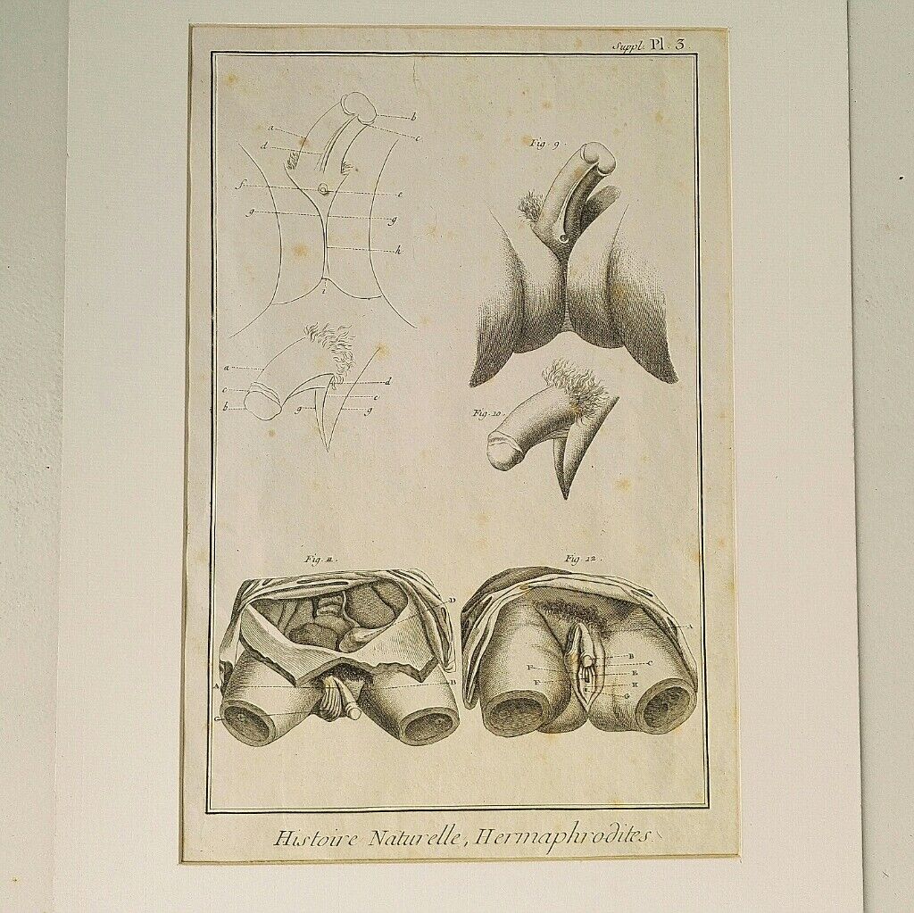 Engravings EIGHTEENth hermaphrodites Diderot cabinet curiosity