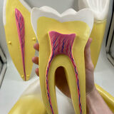 Large size dental model 3 tooth