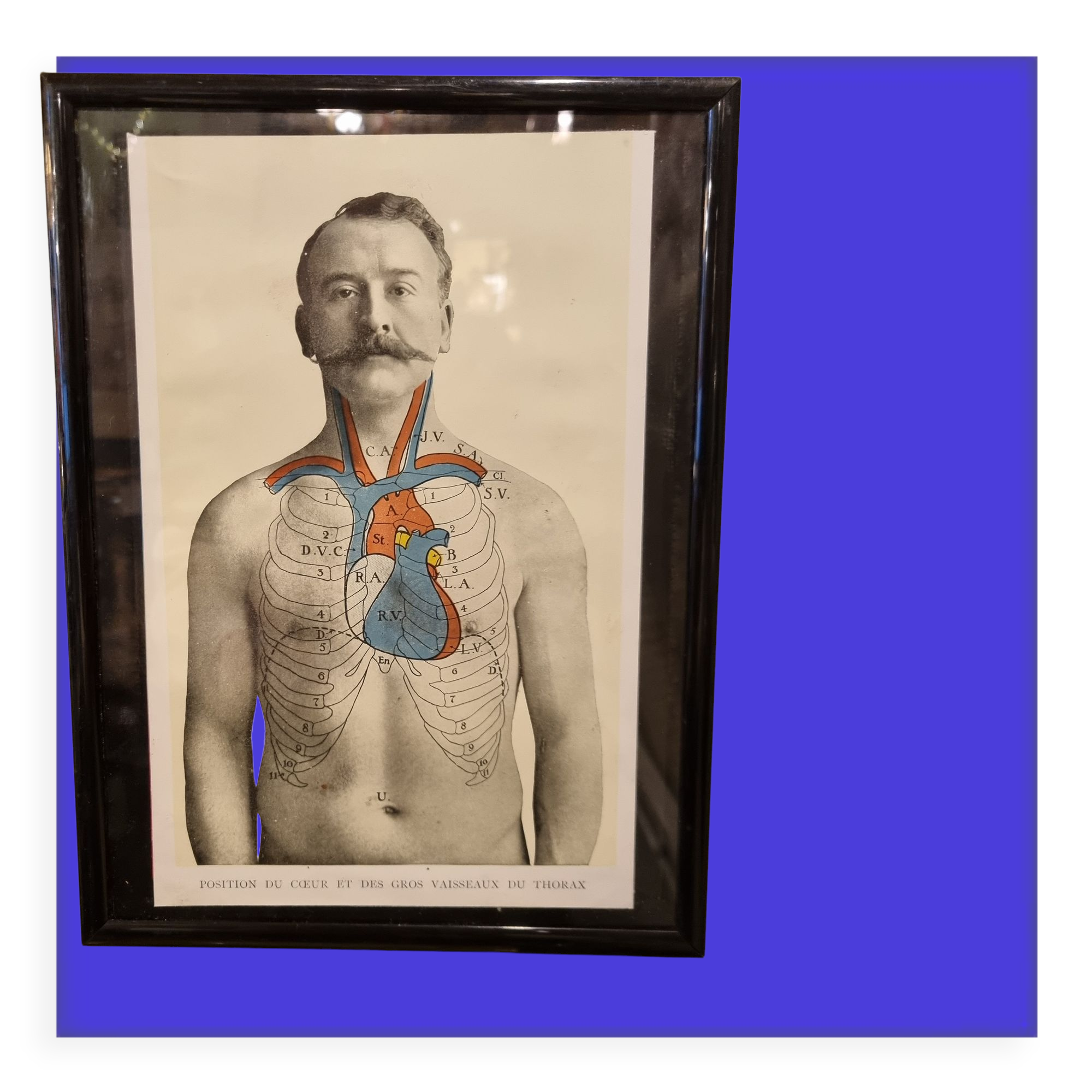 Photo frame book medicine