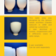 Elisse table lamp by Claudio Salocchi, Lumenform 1968
