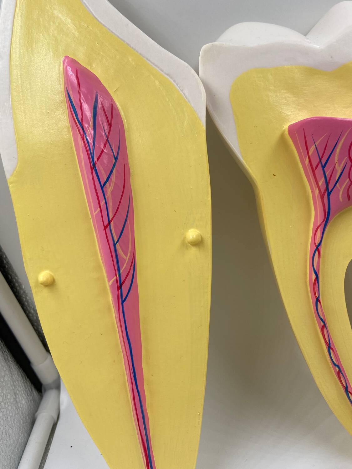 Large size dental model 3 teeth