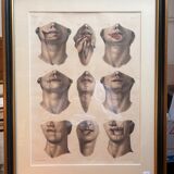 Gravure Cheiloplastic Facial Surgery Anatomy Nicolas Jacob Bourgery