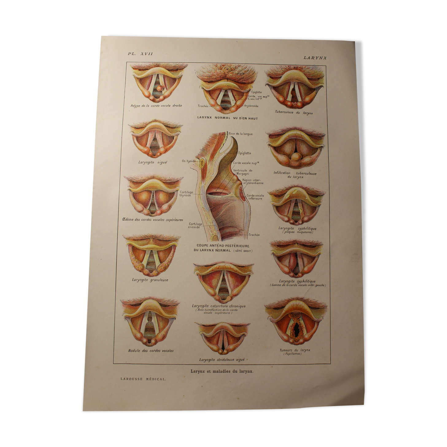 Medical board - anatomy - Larynx