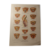 Planche médicale anatomie larynx