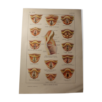 Medical board - anatomy - Larynx