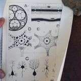 School poster of doctor Auzoux nerve tissue