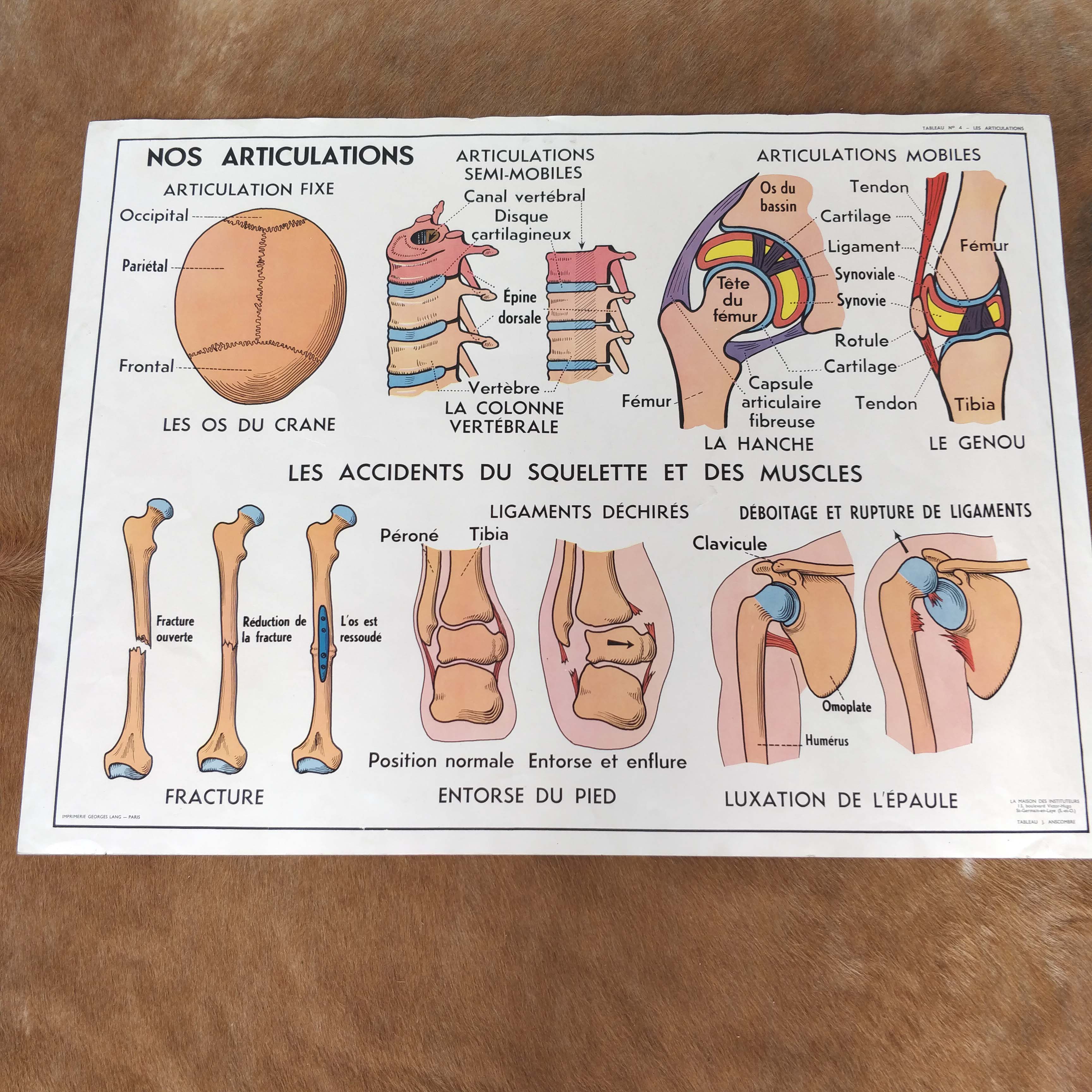 School map and wooden frame MDI Human body