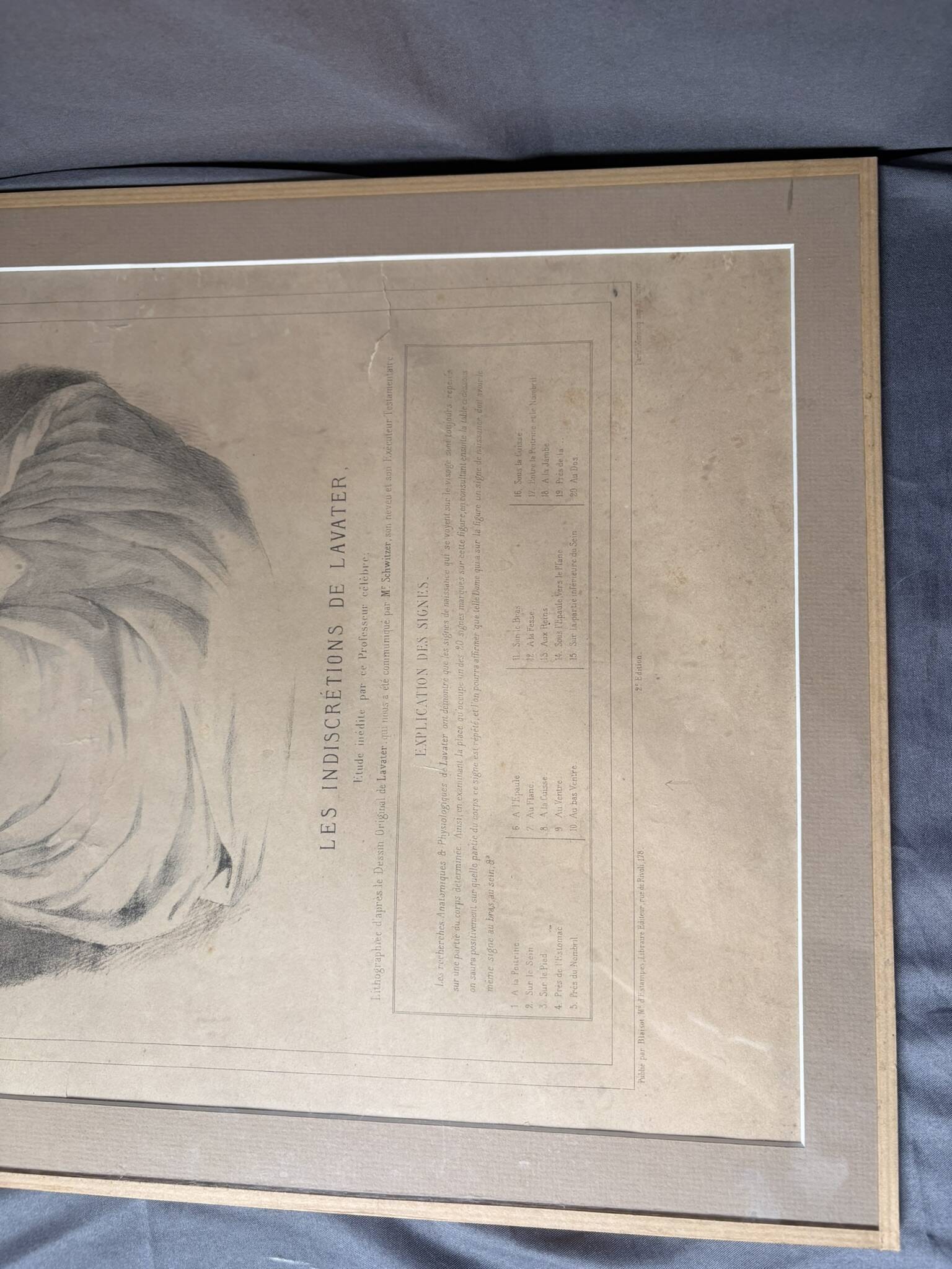 Gravure 19th Century Anatomy Face Woman ANGELO ZAFFONATO "Five Senses"