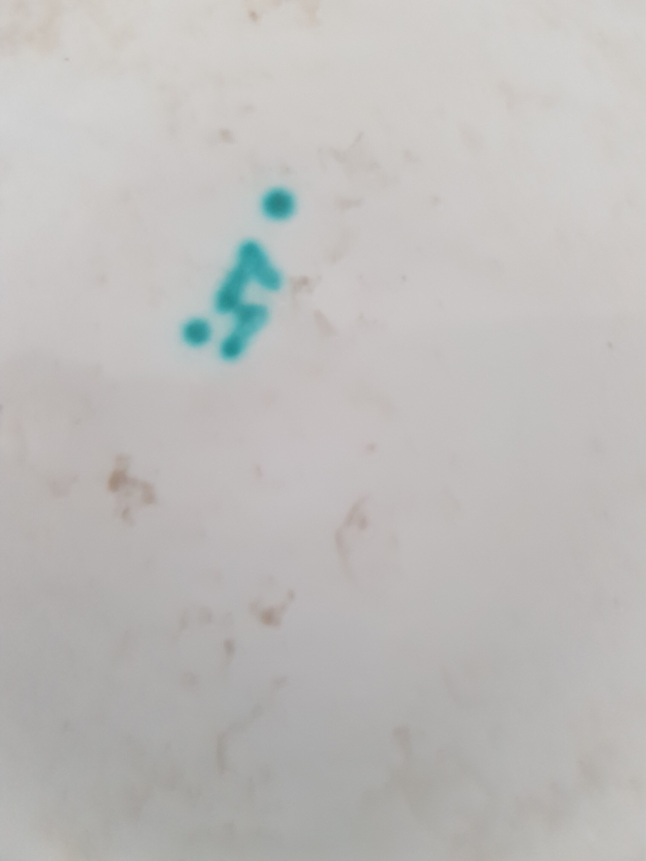 Vase Ball Saint Radegonde