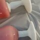 Lot de 2 vases soliflore opaline
