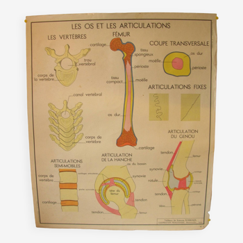 Old school poster Rossignol Bones and joints and accidents 90 cm