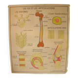 Old school poster Rossignol Bones and joints and accidents 90 cm