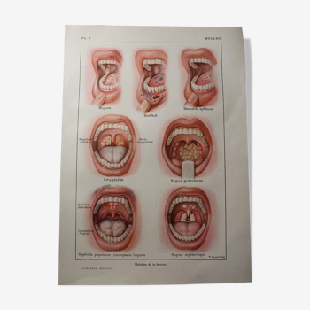 Planche médicale anatomique la bouche