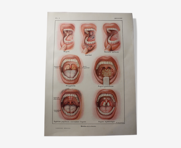 Planche médicale anatomique la bouche