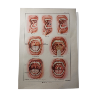 Planche médicale anatomique la bouche