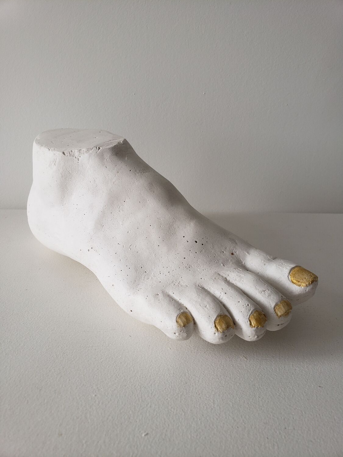 Woman's foot in plaster