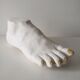Woman's foot in plaster