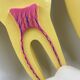 Large size dental model 3 teeth