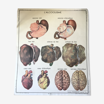 Tableau de sciences Rossignol médecine alcoolisme