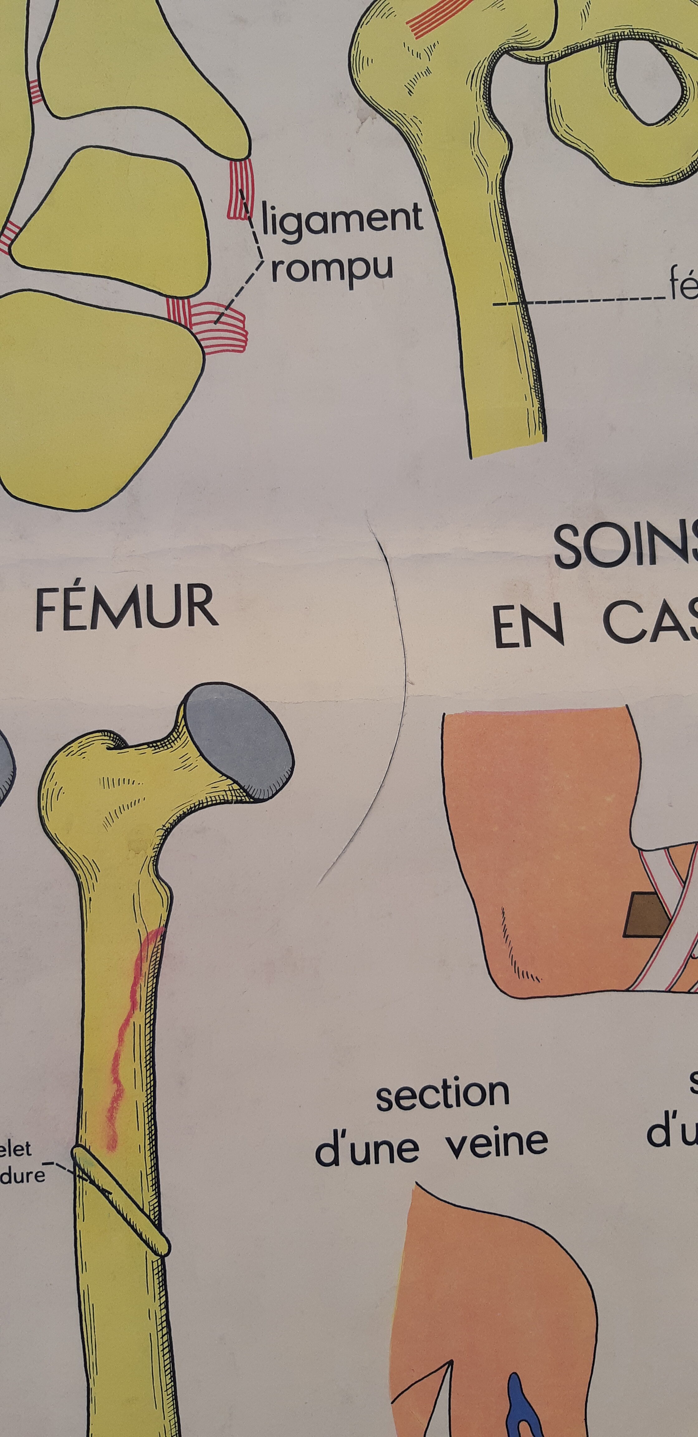 Rossignol educational posters