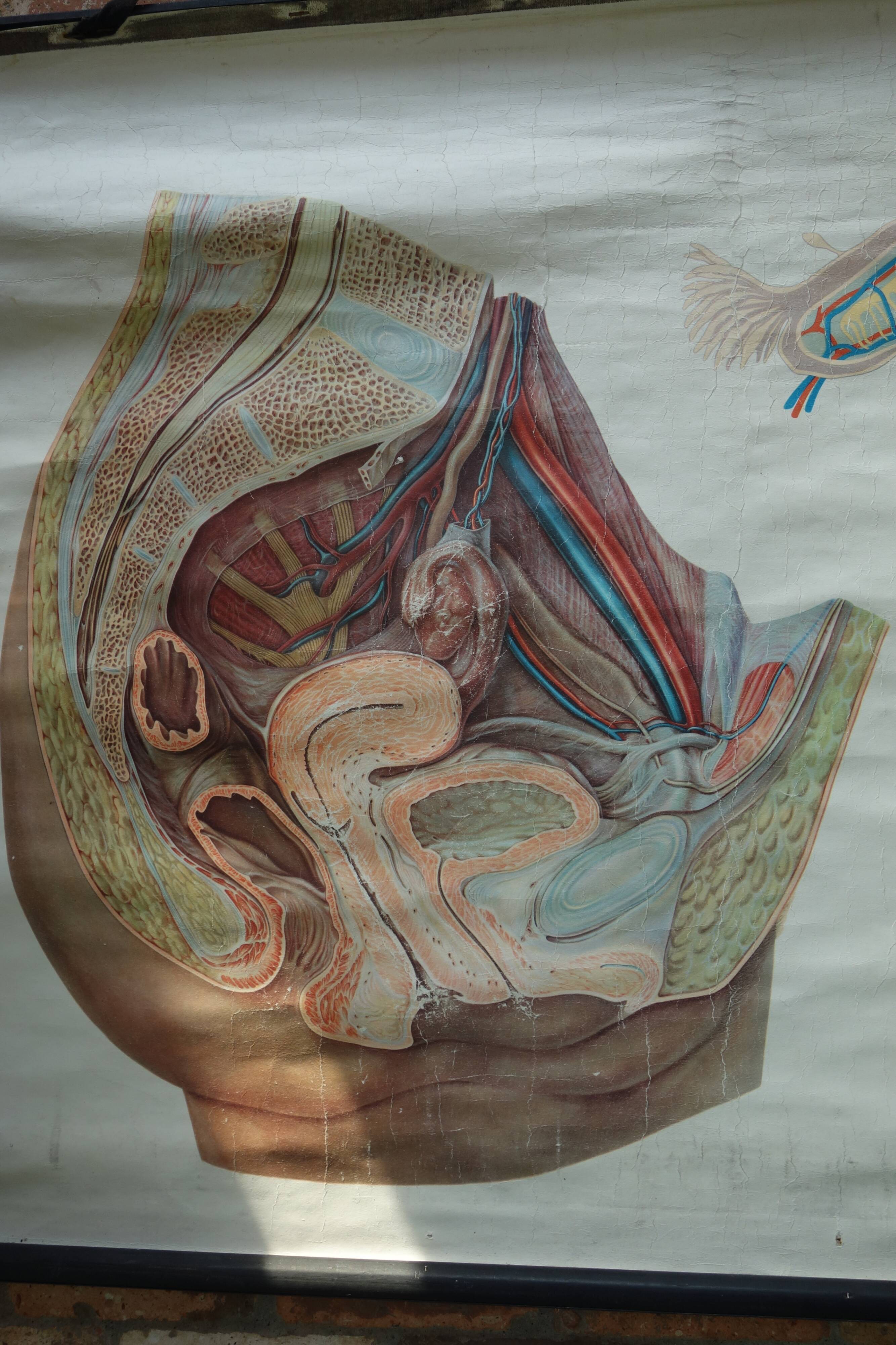 Ancient medical poster