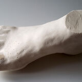 Plaster foot