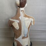 Ecorché