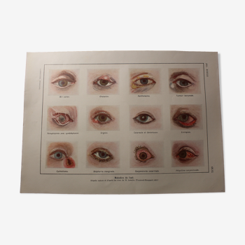 Medical board - anatomy - eye diseases