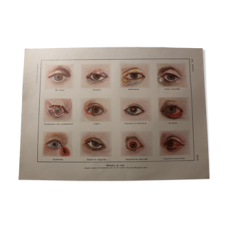 Medical board - anatomy - eye diseases